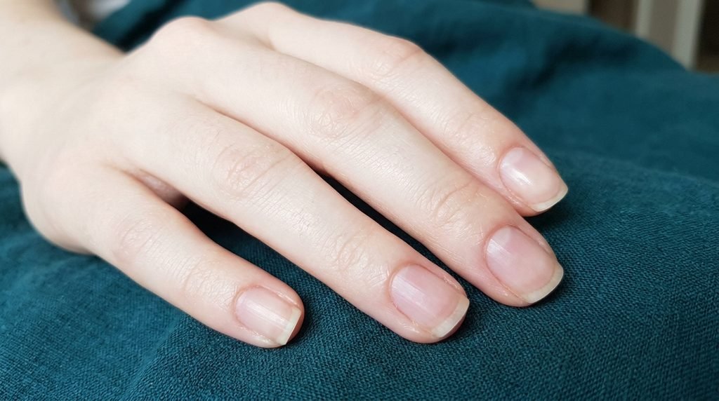 Polish shade swatches of lime green, chartreuse, and neon yellow on an 18-year-old hand with very white skin.